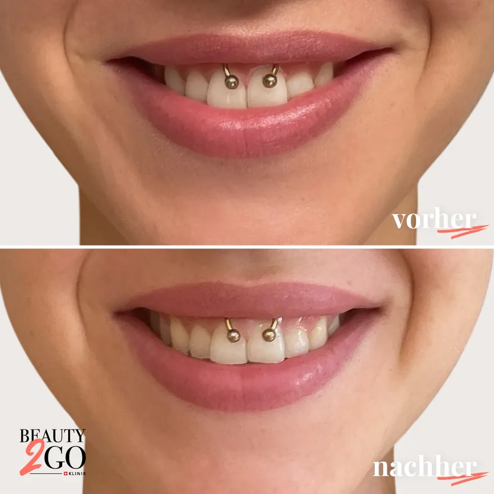 Beauty2Go Klinik - Bern